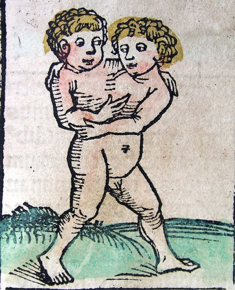 Crap speaks to crap: Conjoined twins in liturgical music Nuremberg Chronicle, Siamese Twins, Twin Tattoos, Medieval Drawings, Medieval Artwork, Conjoined Twins, Ancient Aliens, Moyen Age, Medieval Art