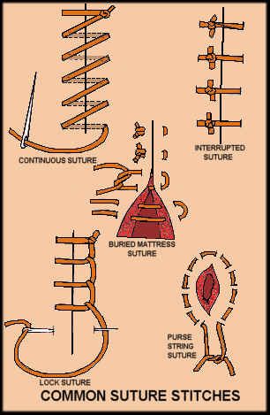 Stitches Medical, Suture Techniques, Knot Tying, Tech Hacks, Survival Life Hacks, Survival Techniques, Medical Studies, Stitching Techniques, Survival Life