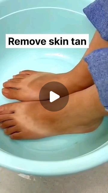 Feet Tanning Removal, Feet Cleaning Home Remedies, Feet Cleaning At Home, Feet Tan Removal Home Remedies, Foot Tan Removal Home Remedies, How To Clean Legs At Home, How To Remove Sun Tan At Home, Pedicure For Tan Skin, Leg Whitening Home Remedies