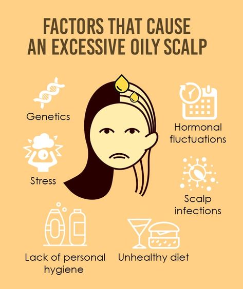 Causes of oily scalp Dandruff Remedy, Unhealthy Diet, Hair Concerns, Hair Issues, Lifeless Hair, Hair Dry, New Hair Growth, Oily Scalp, Greasy Hair Hairstyles