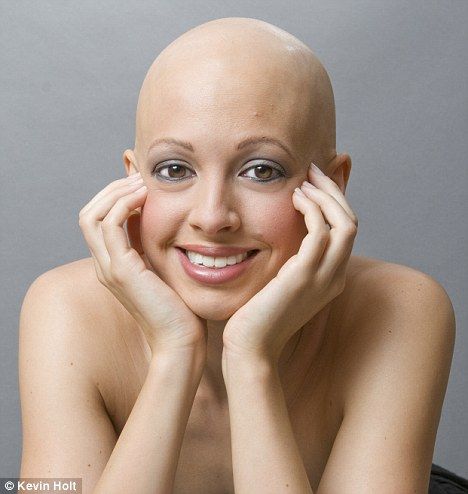 Aimee Blinkhorn Bald Head Women, Skin Diet, Bald Patches, Hair Growth Cycle, Going Bald, Bald Girl, Fashion Model Poses, Regrow Hair, Bald Women