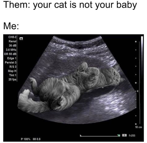 Spoiled Cat, Spoiled Cats, Not Your Baby, Cat Puns, I Love Cats, Cat Pictures, Girl Boss Quotes, Cat Quotes, Funny Cat Memes