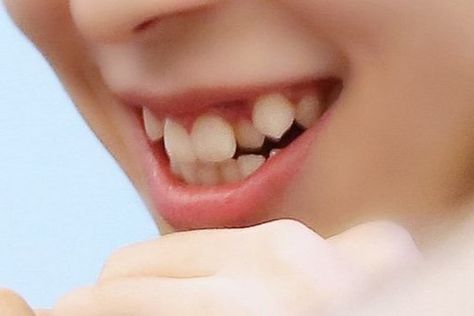 verivery- yeonho smile teeth Yeonho Verivery Smile, Teeth Smile Reference, Rabbit Teeth Smile, Verivery Yeonho, Types Of Teeth, Rabbit Teeth, Oc Story, Human Features, Buck Teeth