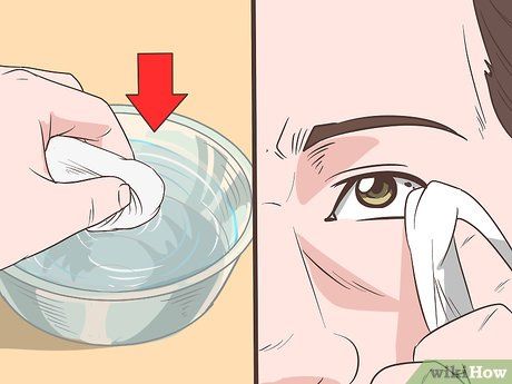 Eye Mites, Whiten Eyes, Eye Health Facts, Eye Health Remedies, Best Eye Drops, Waves Haircut, Eye Twitching, Revenge Spells, Dark Fantasy Artwork