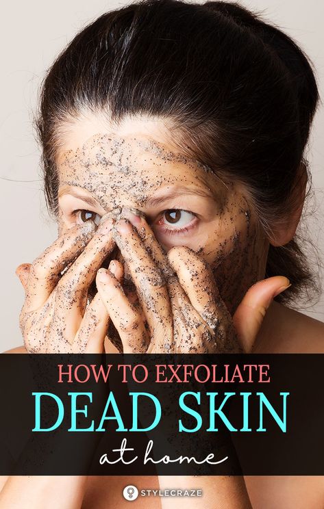 How To Remove Dead Skin Naturally? Blackheads And Whiteheads, Brown Spots On Face, Spots On Face, Get Rid Of Blackheads, Glow Skin, Flaky Skin, Clean Pores, How To Exfoliate Skin, I Love Makeup