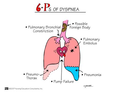 Physical Assessment Memorization Tricks | Nursessity Nursing Information, Medical Mnemonics, Nursing Board, Nursing Assessment, Nursing Mnemonics, Surgical Nursing, Medical Surgical Nursing, Nursing School Survival, Nursing School Studying