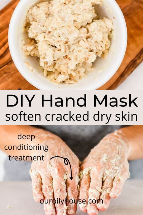 Hand Cream For Dry Cracked Hands, Diy Hand Lotion For Dry Hands, How To Soften Hands Naturally, Diy Nail Mask, Diy Hand Cream For Dry Cracked Hands, Diy Hand Moisturizer, Remedy For Dry Hands, Diy Hand Mask Dry Skin, Homemade Hand Cream For Extra Dry Skin