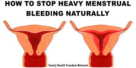 Use These 10 Natural Remedies To Combat Heavy Menstrual Bleeding | Family Health Freedom Network Heavy Menstrual, Menstrual Cramp Relief, Menstrual Pain, Women Face, Menstrual Cramps, Shortness Of Breath, Natural Health Remedies, Family Health, Chronic Fatigue