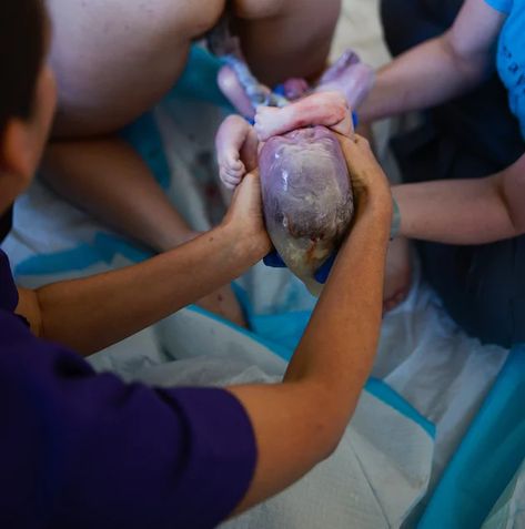 15 Photos That Capture The Beauty of Babies Born With The Amniotic Sac - Stay at Home Mum Stay At Home Mum, Baby Born, Stay At Home, The Beauty, A Photo, At Home, Beauty