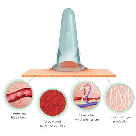 What are the benefits of facial cupping? – The Facial Cupping Expert Benefits Of Cupping, Facial Cupping, Botox Alternative, Face Reading, Botox Injections, Skin Science, Cell Regeneration, Online Tutorials, Skin Routine