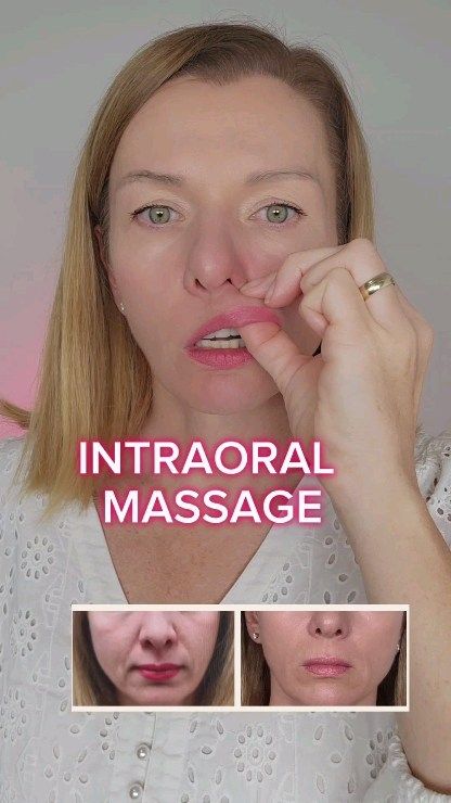 Natalia Gigengak | Natural Face Rejuvenation | 🔥REDUCE NASOLABIAL FOLDS🔥 The main causes of nasolabial folds 👇 🔸The tension of mimic muscles of the central part of the face. 🔸Fat pads… | Instagram Nasolabial Folds Get Rid Of, Frown Lines Around Mouth, Face Yoga Before And After, Get Rid Of Marionette Lines, Jowl Exercises, Malar Bags, Platysma Muscle, Lines Around Mouth, Face Rejuvenation