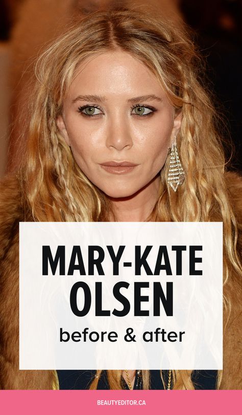 Mary-Kate Olsen, before and after. Mary Kate Olsen Hair, Mary Kate Olsen Wedding, Ashley Olsen Hair, Mary Kate And Ashley Olsen, Kate Olsen, Mary Kate Ashley, Mary Kate Olsen, Ashley Olsen, Mary Kate