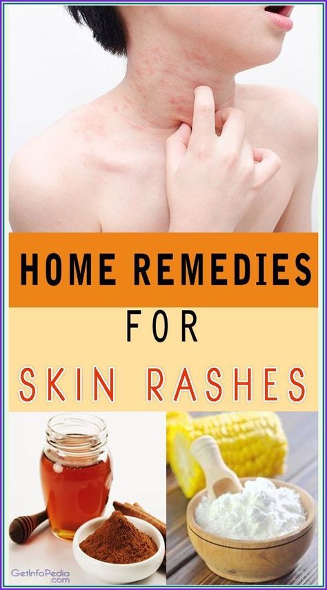 Natural Home Remedies For Skin Rashes Home Remedies For Rashes, Rashes Remedies, Remedies For Skin, Prediabetic Diet, Home Remedies For Skin, Skin Rashes, Skin Irritation, Natural Home Remedies, Natural Home