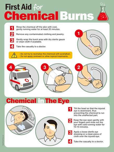 First Aid For Chemical Burns (2) | Safety Poster Shop First Aid Poster, Chemical Burn, First Aid Cpr, First Aid Tips, Chemical Safety, Basic First Aid, Emergency First Aid, Emergency Preparedness Kit, Safety Posters