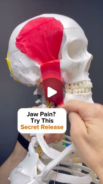 Dr. Joe Damiani - TMJ, Head & Neck Specialist on Instagram: "Have you been beating your master muscle into an oblivion?

 It’s pretty much your only strategy to release jaw, muscle pain and you’re just hammering away at it all day? 

Well, besides the Temporalis and Masseter, the Medial Pterygoid is one of the prime muscles involved in closing your mouth chewing or clenching. In this video, I show you how to get to that hard to reach Muscle to really push in there and Release Some Tension. 

I also show three separate strokes that you can use to get the most out of this release release in this muscle can help to decompress the TMJ and to make moving your mouth easier. 

🚨Most importantly, releasing muscles does not reverse TMJ disorder. It makes the muscles more healthy, but we must look How To Relax Jaw Muscles, Relax Jaw Muscles, Jaw Muscle Release, Scm Muscle Release, Temporalis Muscle, Leg Cramps Causes, Masseter Muscle, Tongue Muscles, Muscle Tension Relief