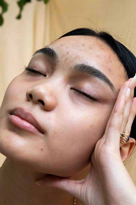 The “Skin Neutrality” Movement Is Growing — But I Can’t Get On Board #refinery29 https://www.refinery29.com/en-us/2019/12/8992367/skin-neutrality-positivity-acne Imperfect Skin Aesthetic, Real Skin Aesthetic, Acne Positivity Art, Acne Photoshoot, Strawberry Freckles, Real Skin Texture, Acne Aesthetic, Imperfect Skin, Beautiful Acne