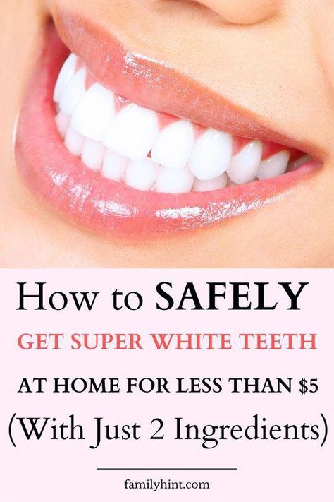 Illuminate your smile with these six speedy methods to whiten your teeth at home: 1. Baking Soda & Hydrogen Peroxide 2. Activated Charcoal Whiten Teeth At Home, Teeth Whiting At Home, Tooth Decay Remedies, Tooth Whitening, Teeth Whitening Remedies, Teeth Whitening Diy, Whitening Products, Whiten Your Teeth, Whiten Teeth