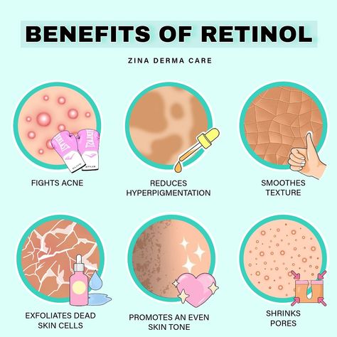 The key to good skin is retinol guys, it fixes everything🙌🏼 Fights Acne: Retinol helps unclog pores, regulate oil production, and reduce inflammation, giving you clearer and blemish-free skin. ✨ Reduces Hyperpigmentation: Retinol stimulates cell turnover, fades pigmentation, and evens out your skin tone, leaving you with a smooth and radiant complexion. 💫 Smooths Texture: Goodbye rough skin! Retinol exfoliates dead skin cells, revealing a fresh and rejuvenated surface Exfoliates Dead Ski... Poor Lifestyle, Retinol Benefits, Healthier Alternatives, Popular Skin Care Products, Face Mapping, Skin Aesthetics, Reduce Hyperpigmentation, Types Of Acne, Reduce Acne