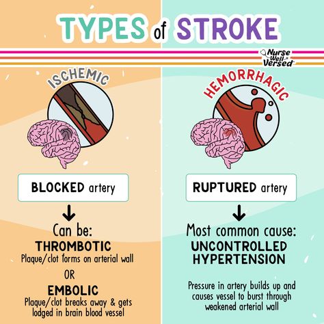 Ischemic Strokes, Different Types Of Strokes, Nursing School Studying Cheat Sheets, Emt Study, Medical Terminology Study, Types Of Strokes, Nursing Board, Nursing School Essential, Medicine Notes