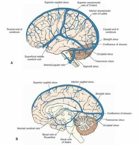 Dural Venous Sinuses, Anatomy Of The Brain, Venous System, Blocked Sinuses, Gross Anatomy, Medicine Notes, Brain Anatomy, The Human Brain, Medical School Studying