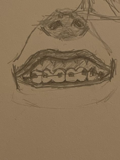 Gummy Smile Drawing Braces Mouth Drawing, Smile Teeth Drawing, Teeth With Braces Drawing, How To Draw Braces On Teeth, Mouth And Teeth Drawing, How To Draw Teeth Smile, Awkward Smile Drawing, How To Draw Smiles With Teeth, How To Draw A Smile With Teeth