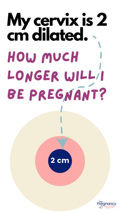 Are you feeling the first signs of labor but unsure of how long it'll take? If you're 2 cm dilated, it's time to start preparing for the big event. In this article, we'll break down what it means to be 2 cm dilated, what to expect during the next stages of labor, and how to stay informed and supported throughout your journey. How To Dilate, 2 Cm Dilated, Dilation Chart, Dilation And Effacement, Cervix Dilation, Cervical Dilation, Signs Of Labor, Pregnancy Timeline, Delivery Nurse Gifts