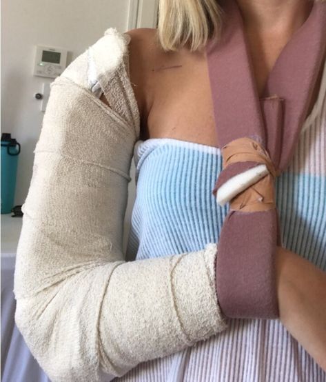 A Broken Humerus — Road to Recovery – Maddie Wirthman – Medium Fractured Shoulder, Arm Excersises, Character Characteristics, Injury Aesthetic, Broken Elbow, Fractured Arm, Humerus Fracture, Elbow Surgery, Recovery Clothes