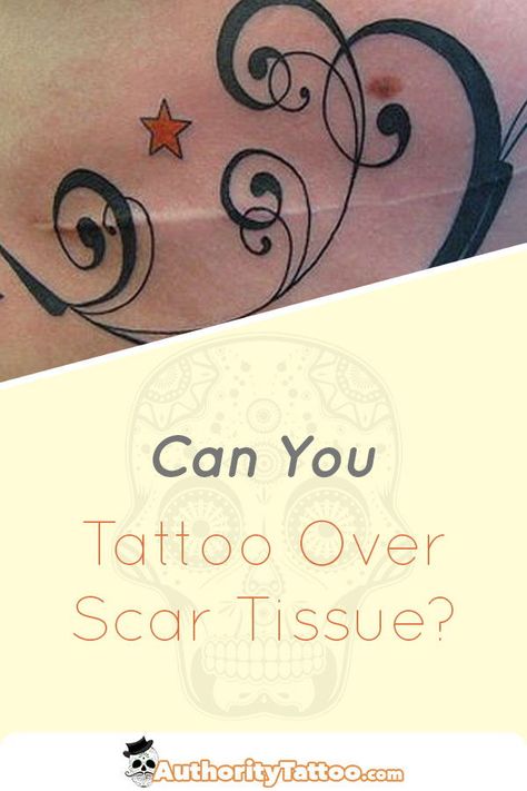 Process Tattoo, Tattoo Over Scar, Learn To Tattoo, Tattoo Tips, Tattoos To Cover Scars, Tattoo Practice, Scar Tattoo, Tattoo Care, Tattoo Equipment