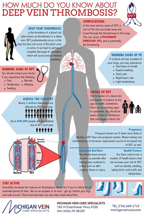 Vascular Ultrasound, Vein Thrombosis, Nursing School Notes, Health And Fitness Magazine, Daily Health Tips, Nursing Notes, Medical Knowledge, Fitness Advice, Good Health Tips