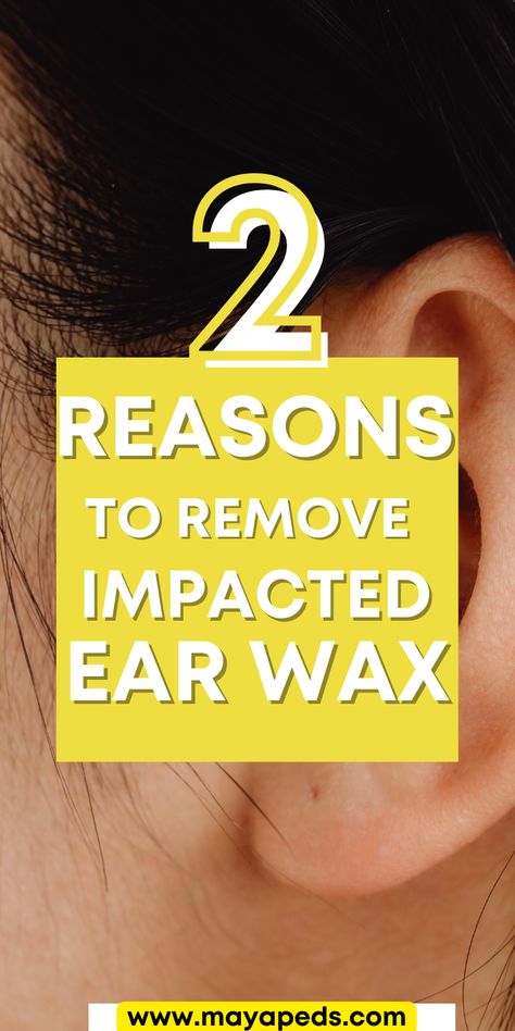 White text over a yellow box: 2 reasons to remove impacted ear wax. www.mayapeds.com. background is image of the side of a person's head, ear and dark hair visible. Remove Ear Wax Buildup At Home, How To Remove Ear Wax Build Up, How To Clean Ear Wax Out, Ear Wax Removal Diy, Ear Wax Removal Impacted, Clean Ear Wax, Clean Ear Wax Out, Unclog Ears, Ear Wax Removal Video