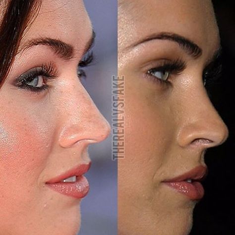 Nose Job Tip Reduction, Megan Fox Nose Job, Megan Fox Before After, Fox Goddess, Jaw Reduction Surgery, Nose Plastic Surgery, Photoshop Magazine, Estilo Megan Fox, Before And After Photoshop