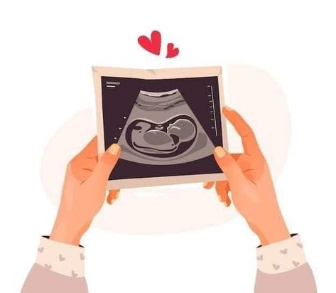 Pregnant Cartoon, Pregnancy Illustration, طفلة حديثة الولادة, Baby Ultrasound, Pregnancy Art, Canva Element Keyword, Hands Holding, Mom Art, Girly Art Illustrations