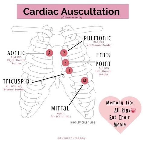 Auscultation Points, Cardiac Assessment, Cardiac Sonography, Paramedic School, How To Remember, Nursing Assessment, Nurse Study Notes, Nursing Student Tips, Cardiac Nursing