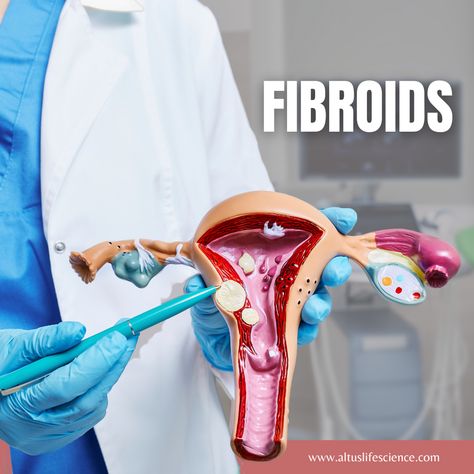 Let's raise awareness about fibroids and support women who may be facing discomfort and health challenges 💪 Fibroids are non-cancerous growths that develop in or around the uterus, affecting many women worldwide. Symptoms of fibroids may include heavy or prolonged menstrual periods, pelvic pain or pressure, frequent urination, and even fertility issues. Remember, you are not alone in this journey! Let's empower each other with knowledge. 🩺💖 . #fibroids #infertility #endometriosis #pcos Fibroid Remedies, Fibroid Uterus, Frequent Urination, Health Challenges, Menstrual Period, Support Women, Gluten Sensitivity, Pelvic Pain, Health Challenge