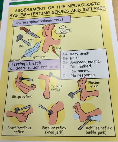 Neurological system Neurological Assessment Nursing, Deep Tendon Reflexes Nursing, Neuro Assessment Nursing, Neurology Notes, Deep Tendon Reflexes, Neuro Nursing, Health Assessment Nursing, Nursing Classroom, Neurology Nursing