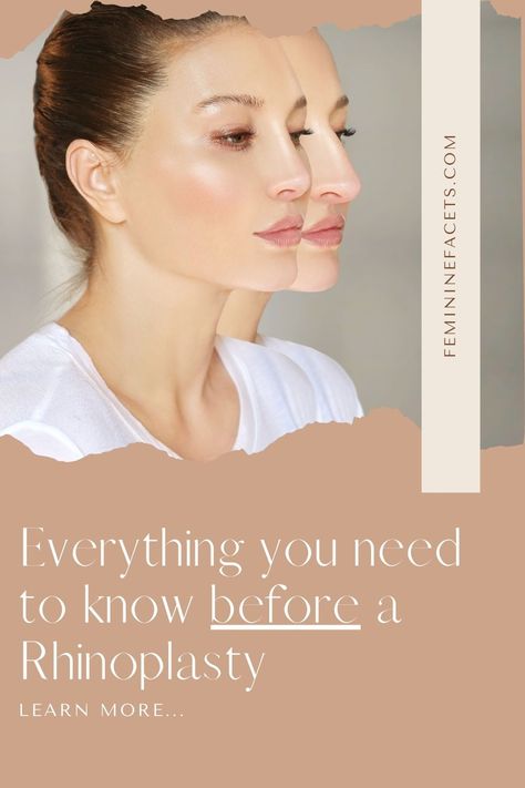 Rhinoplasty recovery tips, nose job timeline & what to know before getting a nose job (rhinoplasty) ♥ Before and After nose job | Rhinoplasty recovery tips| Nose job recovery Rhinoplasty Recovery Tips, Nose Job Before And After Rhinoplasty, Nose Jobs Before And After, Blephoraplasty Before And After, Rhinoplasty Before After, Rhinoplasty Recovery Timeline, Nose Job Before And After, Nose Job Recovery, Biggest Insecurities