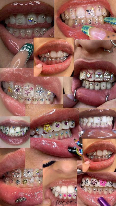 Tooth Gems Collage Diamond In Teeth, Grills For Teeth, Tooth Gem Placement, Diamond Teeth, Dope Jewelry Accessories, Grills Teeth, Tooth Gem, Dope Jewelry, When I Grow Up