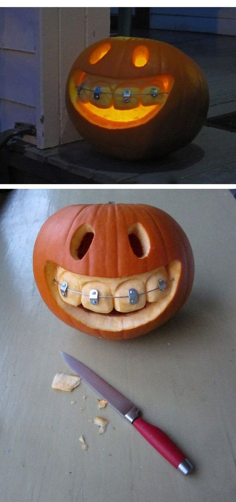 (image) PUMPKIN Jack-o-lantern with Braces ~ fairly easy but an adorably fun design! Would be perfect for those with braces or for use at your dentist or orthodontist office. HINT: use soda can TABS with metal wire to create the braces. Cool Pumpkin Carving Ideas, Cool Pumpkin Carving, Pumpkin Carving Template, Calabaza Halloween, Amazing Pumpkin Carving, Easy Pumpkin Carving, Carving Pumpkins, Halloween Templates, Pumpkin Carving Ideas