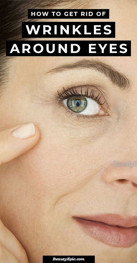 Eye Wrinkles Remedies, Home Remedies For Wrinkles, Lotion For Oily Skin, Get Rid Of Wrinkles, Wrinkle Remedies, Eye Wrinkles, Under Eye Wrinkles, Forehead Wrinkles, Skin Care Wrinkles