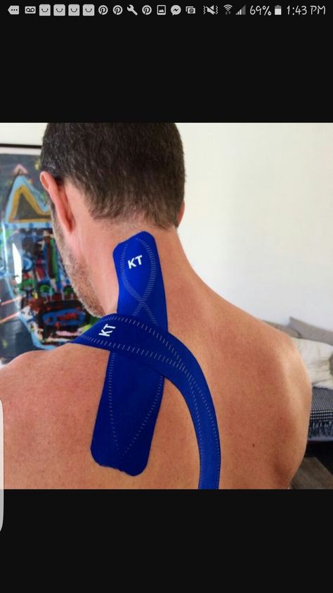 Kinesio taping method for Cervical dystonia Facitis Plantar, Levator Scapulae, K Tape, Hip Flexor Exercises, Kt Tape, Kinesio Taping, Tape Ideas, Feel Energized, Kinesiology Taping