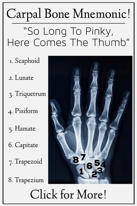 Bone Memorization, Bones Of The Hand And Wrist, Hand Xray Anatomy, Anatomy Easy Learning, Anatomy And Physiology Mnemonics, Wrist And Hand Anatomy, Bones Names Anatomy, Carpal Bones Mnemonic, Carpal Bones Anatomy