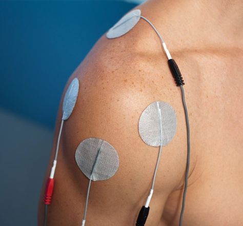 Benefits of Electrical Muscle Stimulation For Athletes Tens Electrode Placement, Tens Unit Placement, Medical Branding, Electrical Muscle Stimulation, Spa Photos, Electric Muscle Stimulator, Shoulder Dislocation, Tens Machine, Foot Exercises