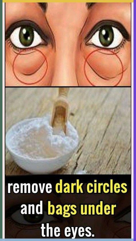 Dark Spots Remedies, Anti Aging Remedies, Wrinkle Remedies, Wrinkle Free Skin, Dark Spots On Face, Homemade Scrub, Remove Dark Circles, Remove Dark Spots, Wrinkled Skin