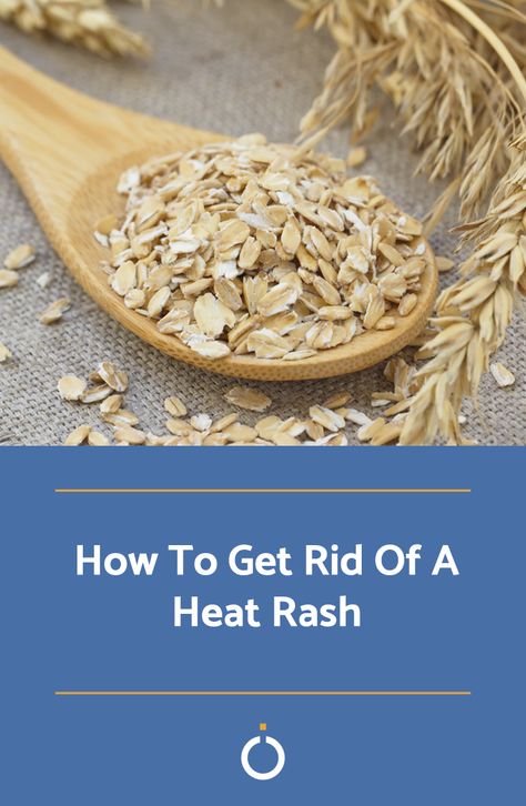 Prickly Heat Rash Remedies, How To Get Rid Of Heat Rash, Heat Rash Remedy For Adults, Remedies For Heat Rash, Heat Rash On Face, Heat Rash Remedy, Home Remedies For Rashes, Prickly Heat Rash, Home Remedies For Face