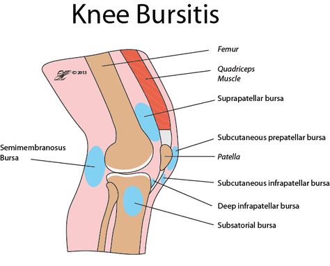 Pain around the Knee (Inflammed Bursitis) Bursitis Knee, Common Knee Injuries, Parts Of The Knee, Knee Pain Relief Exercises, Core Exercises For Women, Joints Pain Remedy, Swollen Knee, Knee Strengthening Exercises, How To Strengthen Knees