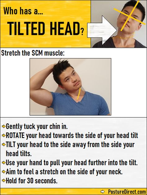 If your head is tilted to one side, try this recommend exercise to stretch out the Sternocleidomastoid muscle. How To Stretch Trapezius Muscle, Intercostal Muscles Exercise, Sternocleidomastoid Muscle Stretch, Intercostal Muscles, Posture Tips, Muscle Contraction Steps, Sternocleidomastoid Muscle, Tilt Head, Muscle Stretches