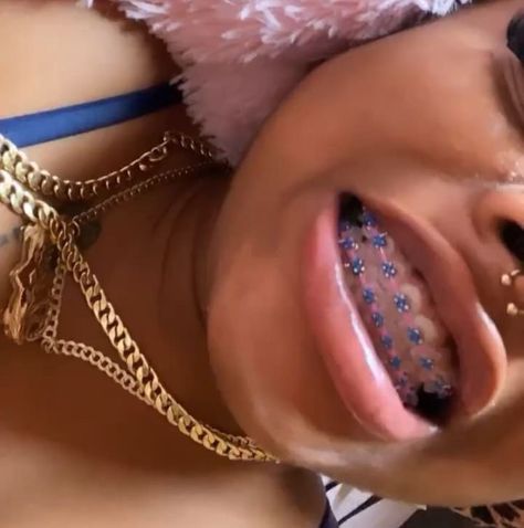 dα вrαt🧞‍♀️. Gold Braces With Color Bands, Dark Skin With Braces, Braces Aesthetic Girl, Braces With Rubber Bands, Braces Black Women, Brace Ideas, Power Chain Braces, Braces Colours, Dental Braces Colors