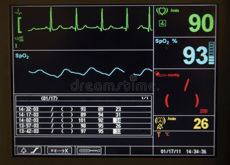 Heart monitor. Close up of the cardiac monitoring device screen , #AFFILIATE, #Close, #monitor, #Heart, #cardiac, #screen #ad Heart Monitor Aesthetic, Cardiac Monitoring Nursing, Heart Rate Monitor Aesthetic, Hart Beat, Cardiac Output, Hospital Heart Monitor, Heartbeat Monitor, Heart Doctor, Heart Monitor