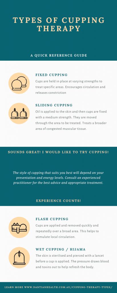 What Types of Cupping Therapy Are There? | Dantian Health Cupping Placement Chart, Wet Cupping, Benefits Of Cupping, Hijama Cupping, Fire Cupping, Cupping Massage, Cupping Therapy, Preventative Health, Simpler Lifestyle