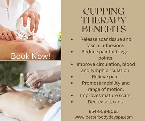 Vacuum Therapy Benefits, Ventosas Cupping Therapy, Cupping Massage Benefits, Vacuum Cupping Therapy, Vacuum Therapy Before And After, Hijama Cupping Therapy Poster, Benefits Of Cupping Therapy, Cupping Therapy Chart, Cupping Benefits